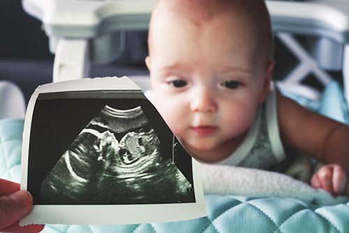 試管嬰兒：胚胎移植的小(xiǎo)知(zhī)識